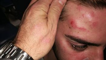 Els joves foren increpats i agredits per la seva condició sexual i per parlar en català.